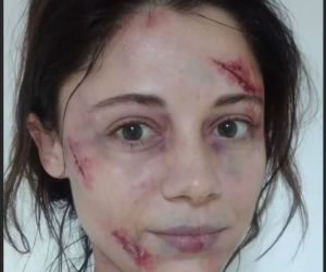 M jak miłość. Adriana Kalska (Iza Lewińska) pobita