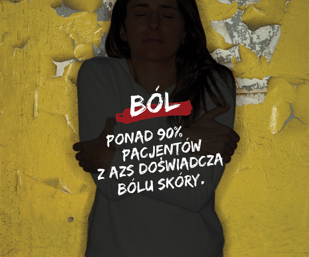 Portret atopika – poruszająca sesja zdjęciowa