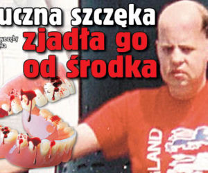Sztuczna szczęka zjadła go od środka