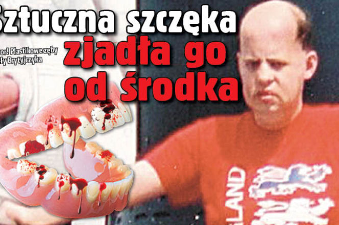 Sztuczna szczęka zjadła go od środka
