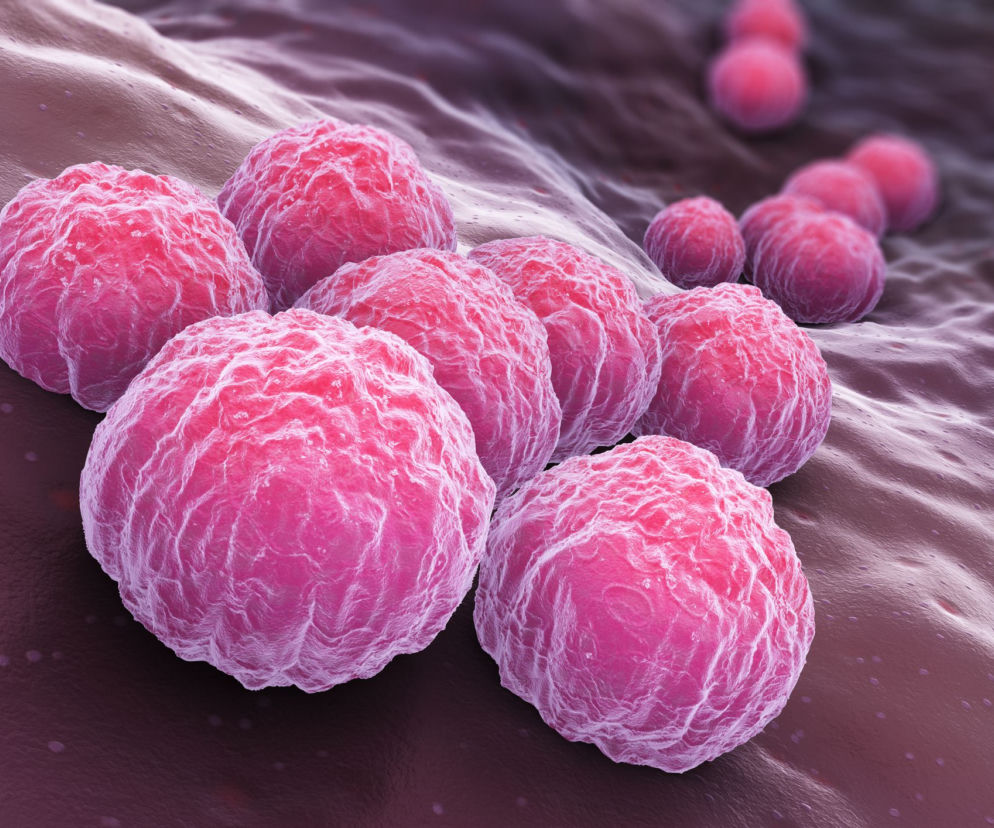 chlamydia