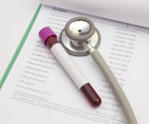 Co oznacza niski poziom leukocytów w morfologii? Oto możliwe przyczyny leukopenii