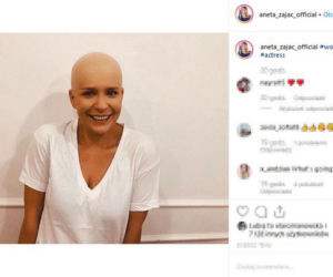 Aneta Zając pokazała swoje zdjęcie bez włosów