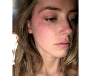 AMBER HEARD POBIŁA SIĘ SAMA?