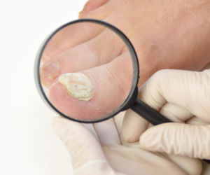 Diagnostyka drożdżycy