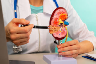 Kamienie nerkowe dotykają miliony osób. Tych 5 łatwych trików może znacząco obniżyć ryzyko ich powrotu