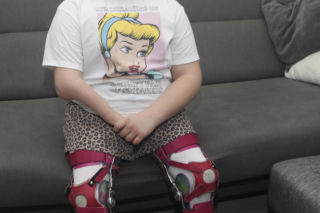 Podarujmy Amelce protezy pod choinkę