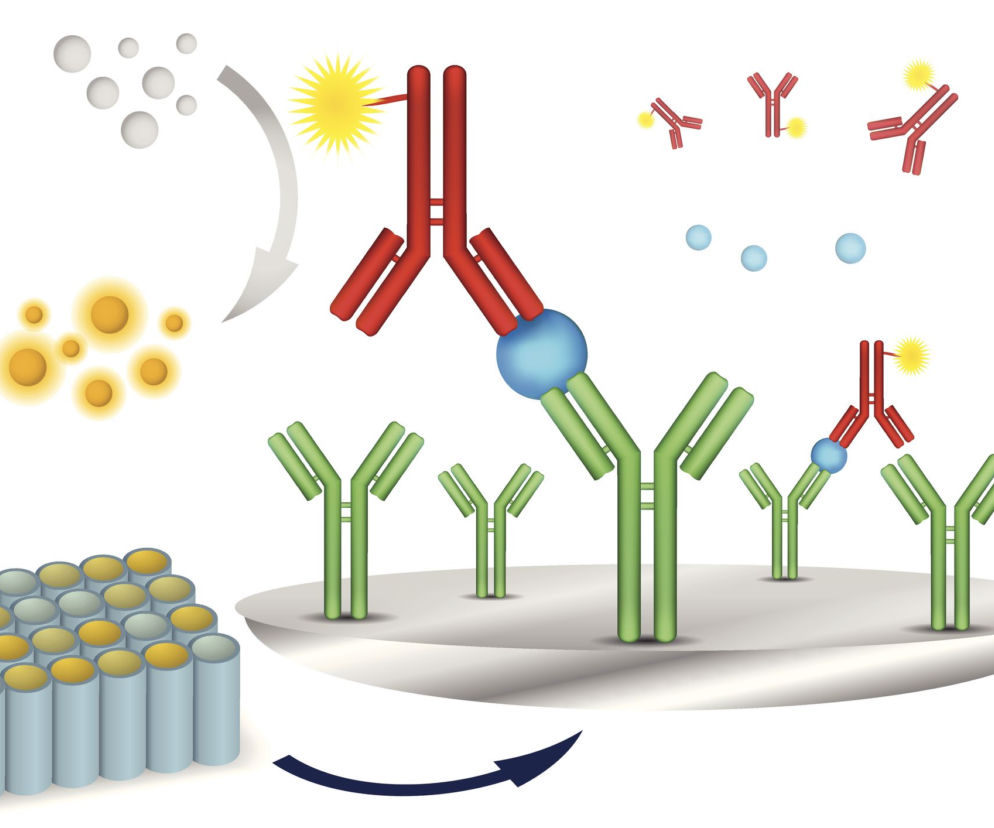 Immunoglobulina
