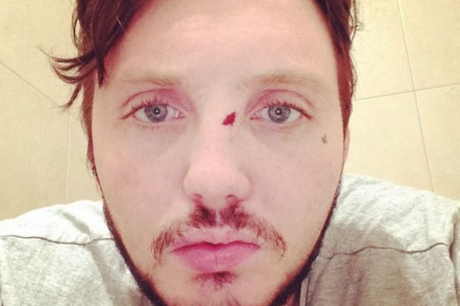 James Arthur