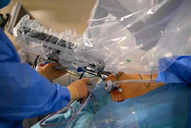 Polscy lekarze z Chin zoperaowali pacjentów w Warszawie. To pierwsze w historii operacje telerobotyczne na taką odległość