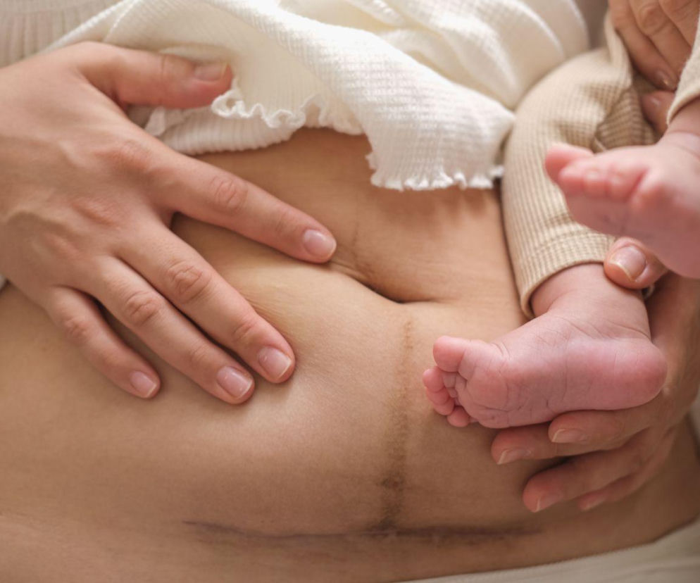 Fantomowe kopnięcia po porodzie. Czuje je co druga mama