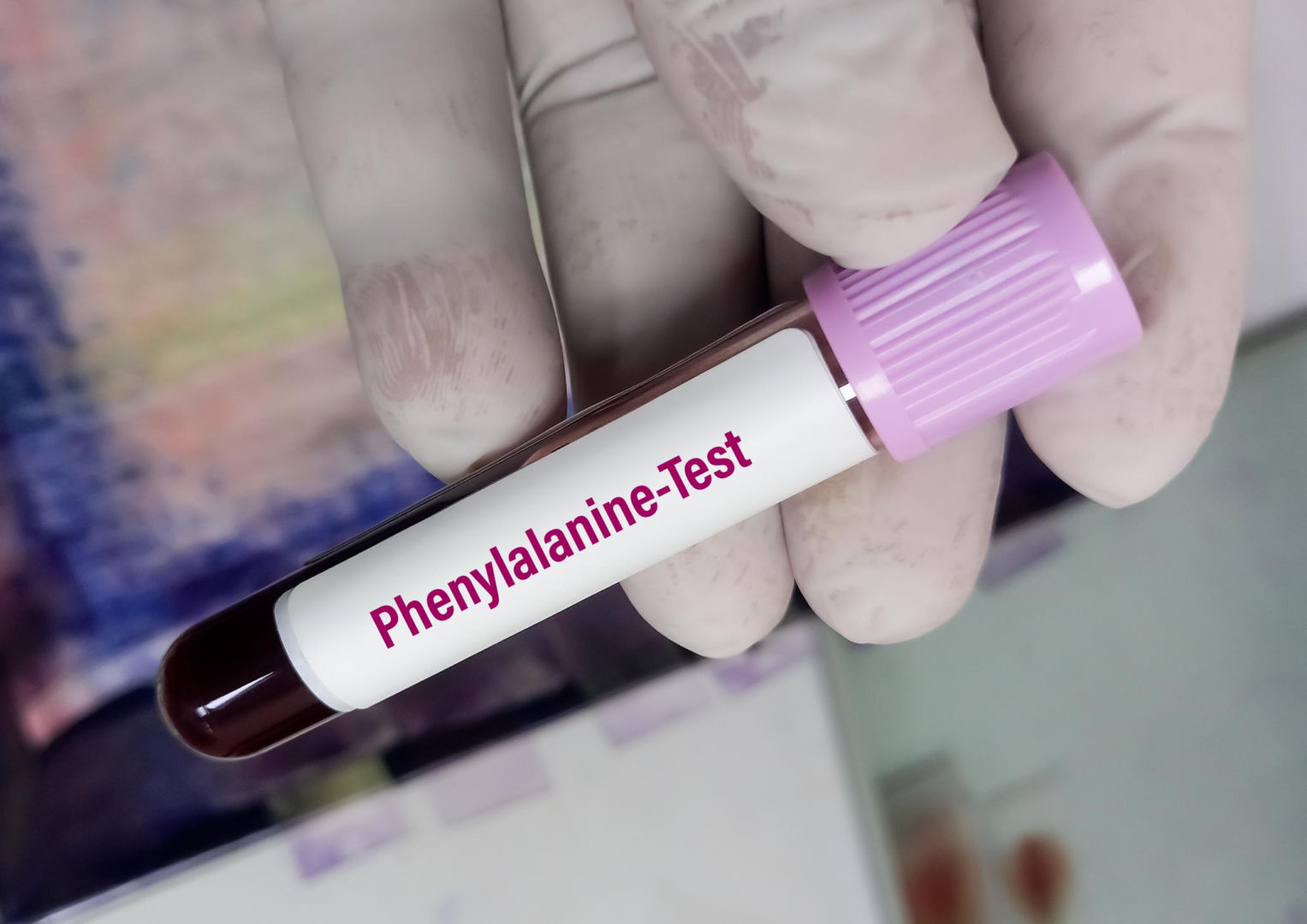 test na fenyalanine
