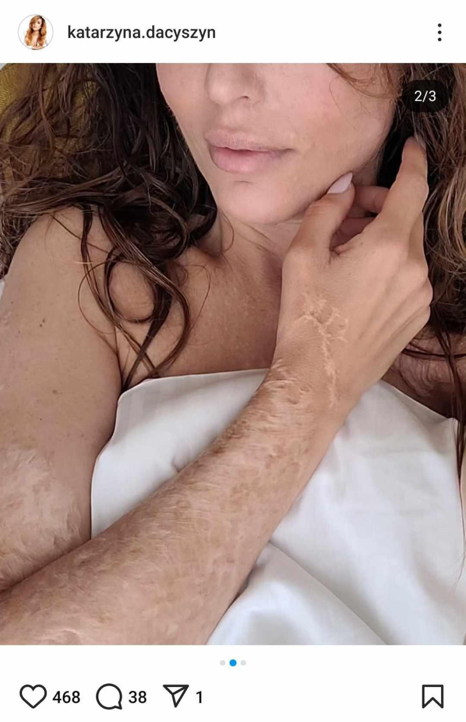 Katarzyna Dacyszyn
