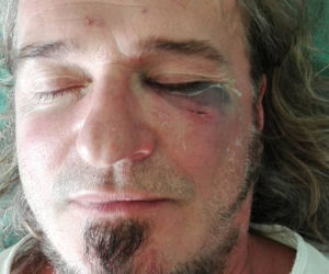 Miał wystąpić na Woodstocku. Został brutalnie pobity