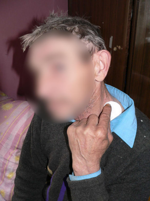Tragedia na Mazowszu. Przez chorą fascynację jedna osoba zginęła, a dwie zostały ranne