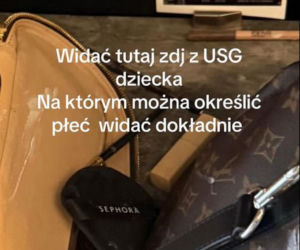 Wersow niezamierzenie ujawniła płeć dziecka? Internauci wskazują dowody