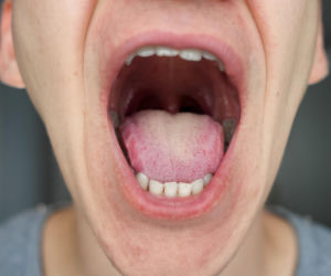 Budzisz się z takimi śladami na języku? Koniecznie sprawdź poziom kluczowej witaminy