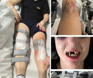 Paweł W. mógł zabić młode małżeństwo przygniatając ich samochodem do ściany