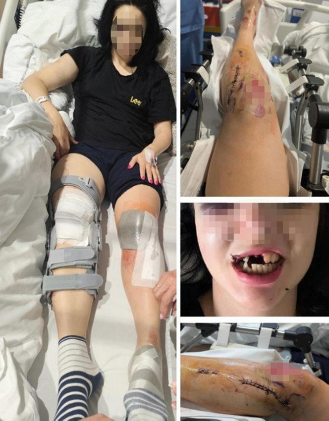 Paweł W. mógł zabić młode małżeństwo przygniatając ich samochodem do ściany