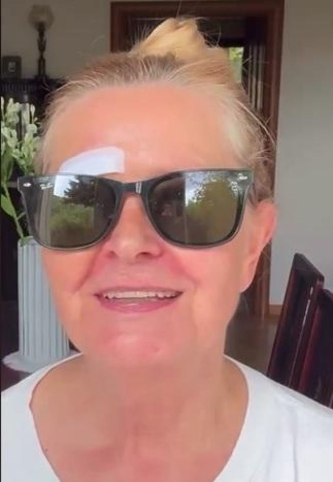 Barbara Busztynowicz miała wypadek! Skończyło się szyciem. "Nikt się nie zatrzymał"