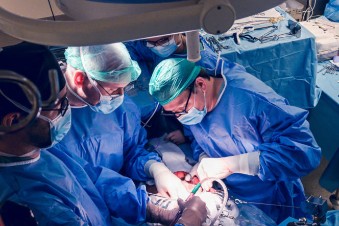 Lekarze WUM usunęli guza z wątroby poza ciałem. Pierwsza taka operacja w Polsce