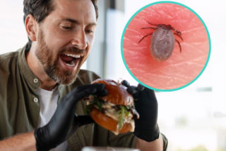 Ugryzienie kleszcza, a potem wstrząs po burgerze. Coraz więcej zachorowań na zespół alfa-gal