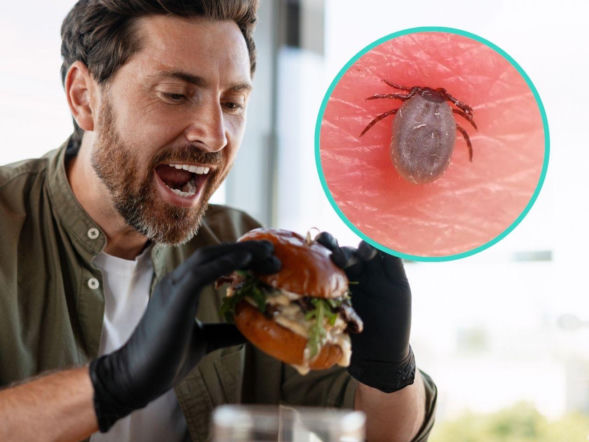 Ugryzienie kleszcza, a potem wstrząs po burgerze. Coraz więcej zachorowań na zespół alfa-gal