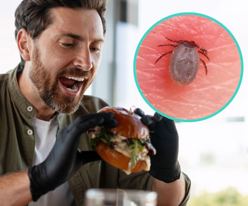 Mężczyzna z brodą i w rękawiczkach trzyma apetycznego burgera, z otwartymi ustami. W prawym górnym rogu znajduje się zbliżenie na kleszcza wbitego w skórę. Ilustruje to związek między ukąszeniem kleszcza a alergią na mięso, o której przeczytasz więcej na Poradnik Zdrowie.