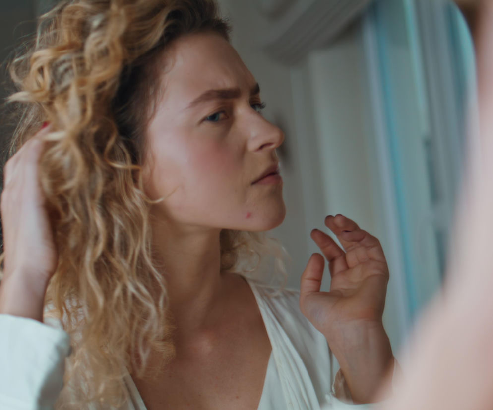 To nie tylko hormony. Wyeliminuj ten jeden produkt z diety, a twoja cera wreszcie odetchnie