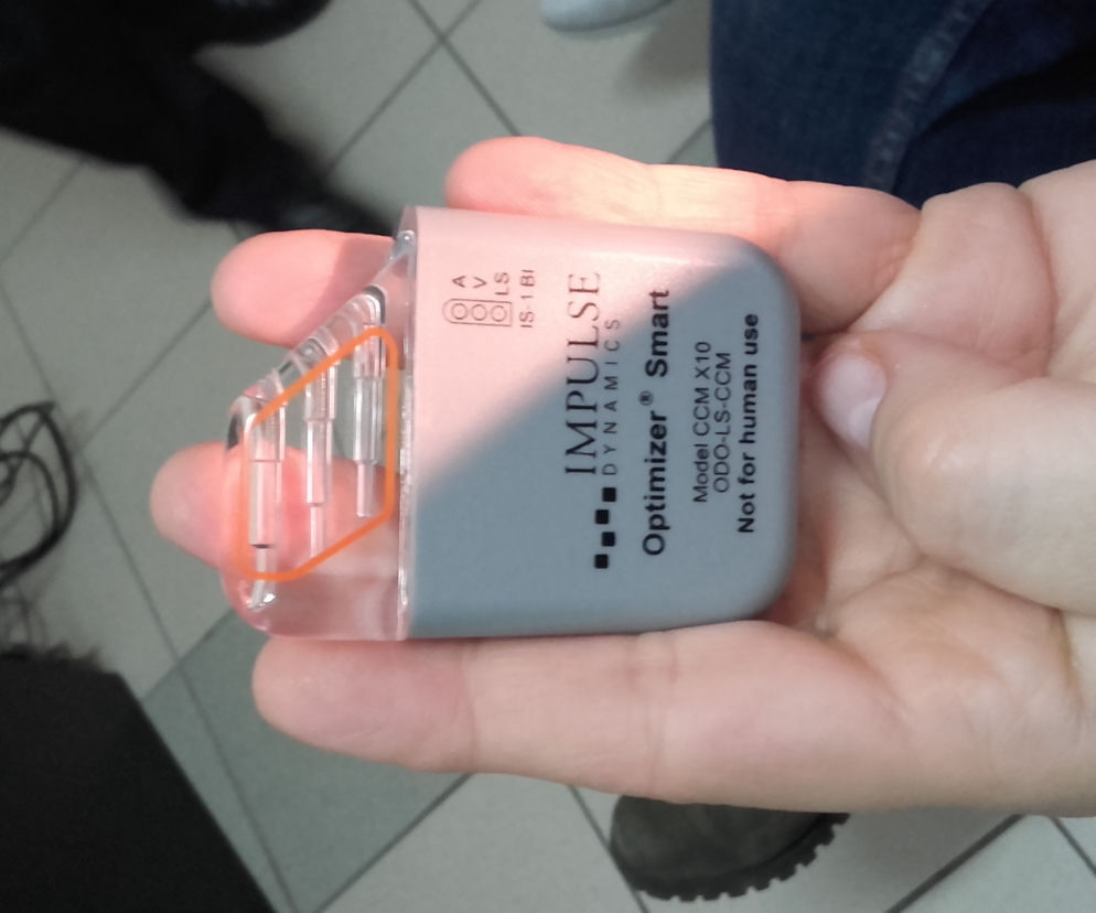 Nowy model rozrusznika najlepiej współpracuje z organizmem niż poprzedni typ urządzenia