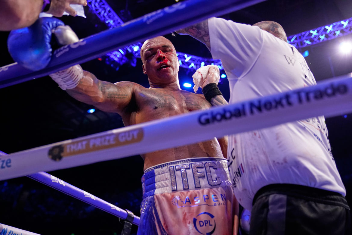 Krwawa walka Daniel Dubois Fabio Wardley o mistrzostwo świata