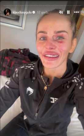 Klaudia Syguła po walce