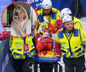 Kamila Sellier po wypadku przeszła rekonstrukcję oczodołu! Pokazała się po zabiegu