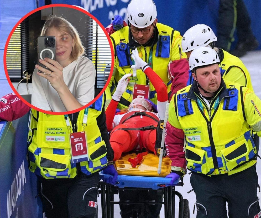 Kamila Sellier już po operacji twarzy. Pokazała poruszające zdjęcia