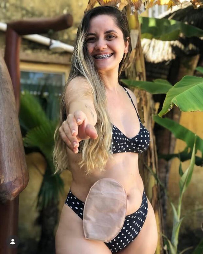 Nie żyje popularna influencerka. Dziewczyna pokazywała w sieci, jak walczy z chorobą