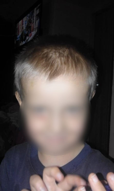 Ośmioletni Kamil z Częstochowy był katowany od tygodni
