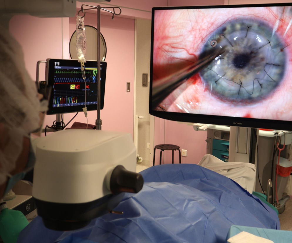 Szpital św. Barbary z rekordem zabiegów przeszczepu rogówki