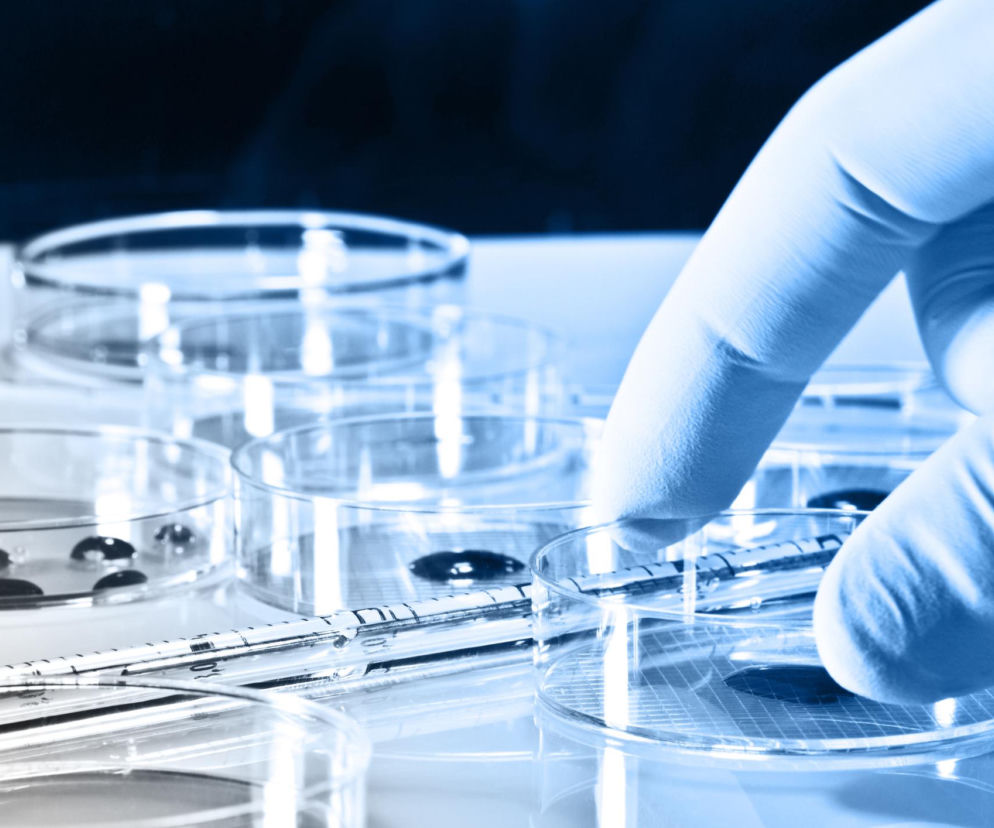 Dłoń w jasnoniebieskiej rękawiczce laboratoryjnej trzyma szalkę Petriego z próbką. W tle widoczne kolejne szalki z ciemnymi kroplami. Obraz symbolizuje badania nad witaminą B7 i jej rolą w rozwoju raka, o których można przeczytać na portalu Poradnik Zdrowie.