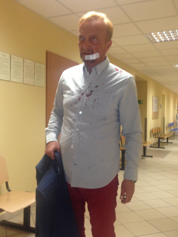 Arkadiusz Nader, policjant z Rancza pobity przez żonę Wioletkę?!