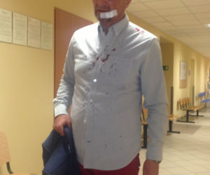 Arkadiusz Nader, policjant z Rancza pobity przez żonę Wioletkę?!
