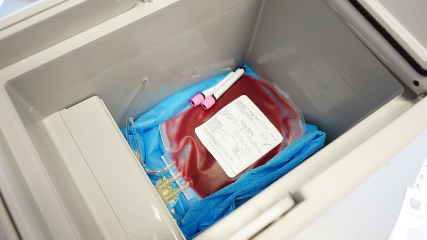 Transplantacja
