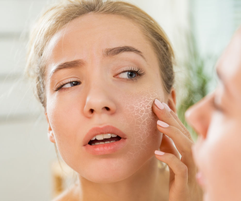 Młoda kobieta ze suchą, popękaną skórą na policzku, spoglądająca w lustro z zaniepokojeniem. Dotyka twarzy palcem, co podkreśla problem przesuszenia. Artykuł na Poradnik Zdrowie wyjaśnia, jak uniknąć takich błędów w pielęgnacji.