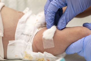 Kontrowersje wokół szczepień. Rodzice noworodków zdezorientowani, a lekarze grzmią: „Gruźlica to nie żarty!”