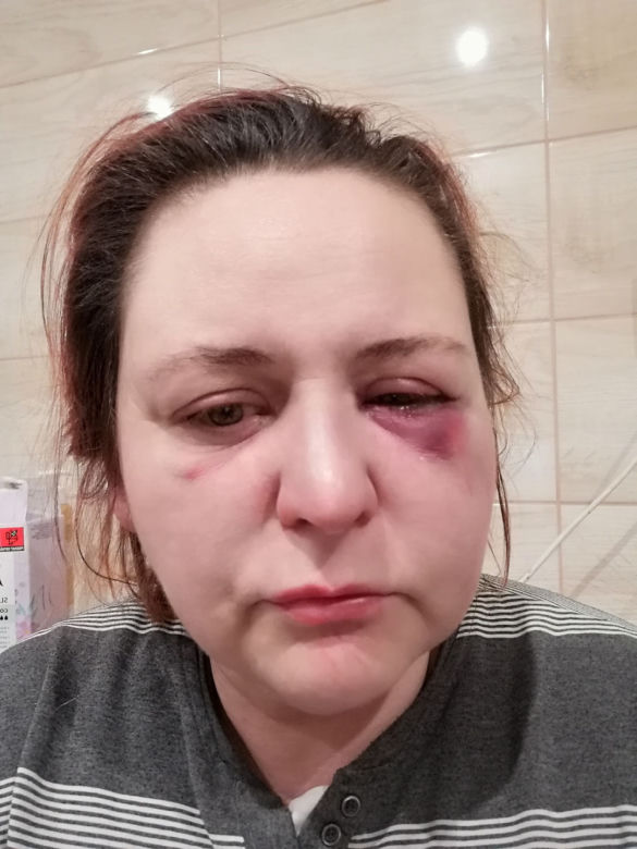 Sąsiad zgotował jej piekło! "Na koniec usiadł mi na głowie"