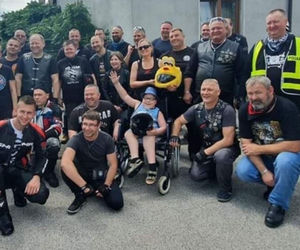 Gabryś przeszedł 17 operacji, tylko na twarzy i dłoniach nie ma blizn. Jego pają jest pomoc innym!