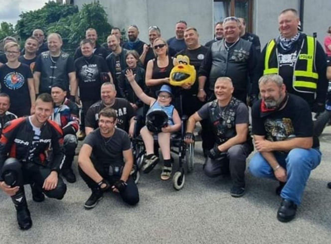 Gabryś przeszedł 17 operacji, tylko na twarzy i dłoniach nie ma blizn. Jego pają jest pomoc innym!