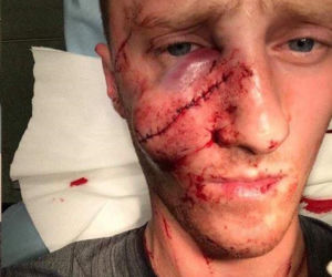 Jastrzębie: Horror podczas meczu hokeja. Kamil jest ciężko ranny 