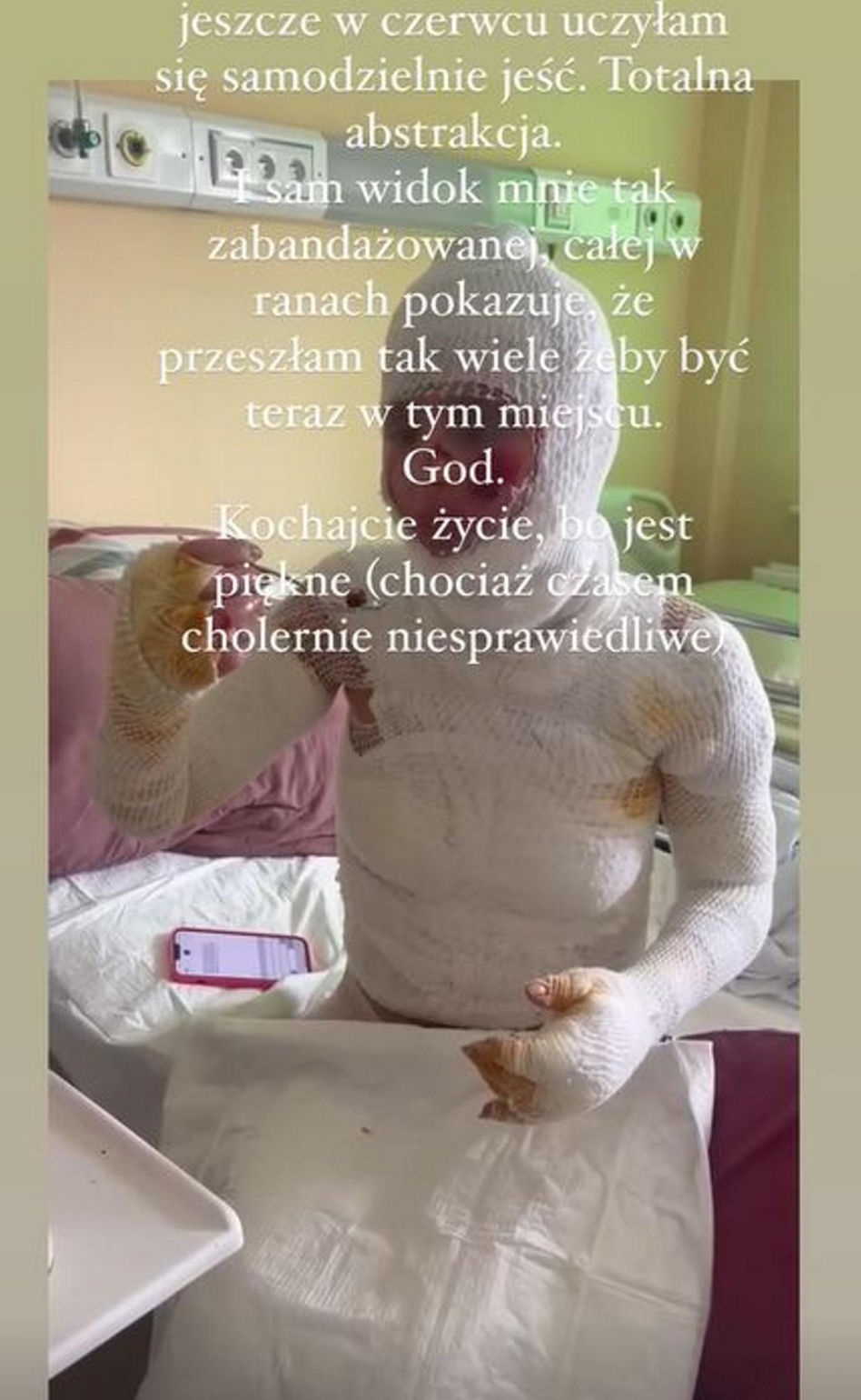 Maja Kuczyńska przeżyła piekło. Całe ciało w oparzeniach