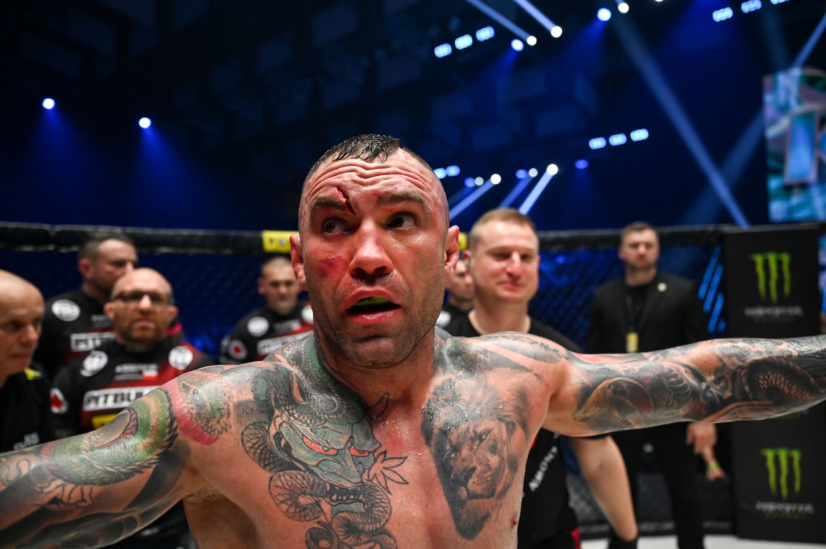 Paczuski: Potworne rozcięcie na twarzy gwiazdy KSW