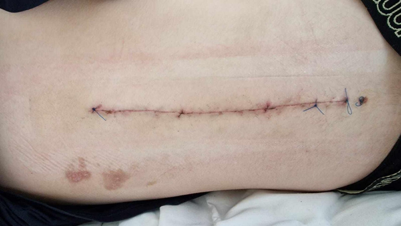 Skandalicznie niski wyrok dla sprawcy potrącenia nastolatki na pasach